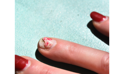 What to do when a false nail is pulled out